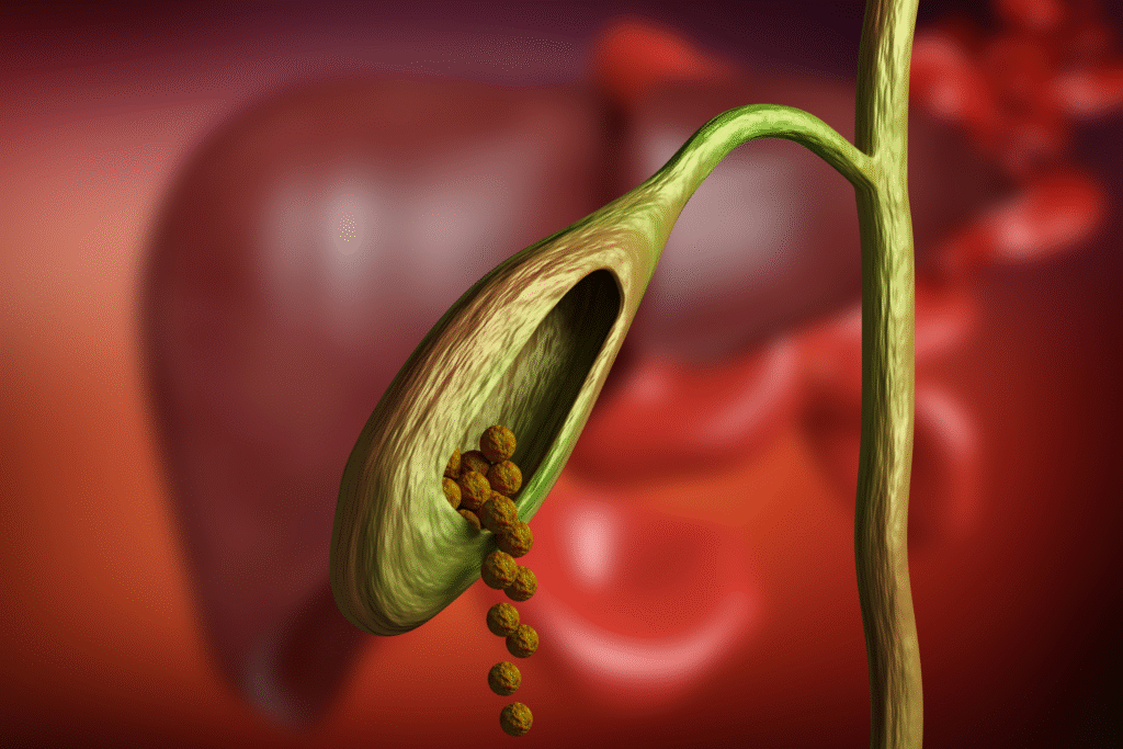 Small bowel surgery expert Hyderabad