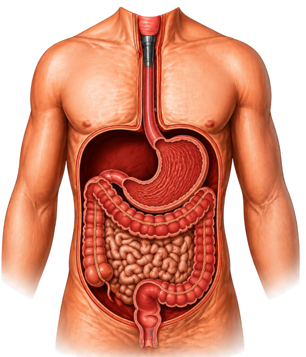 Rectal Prolapse